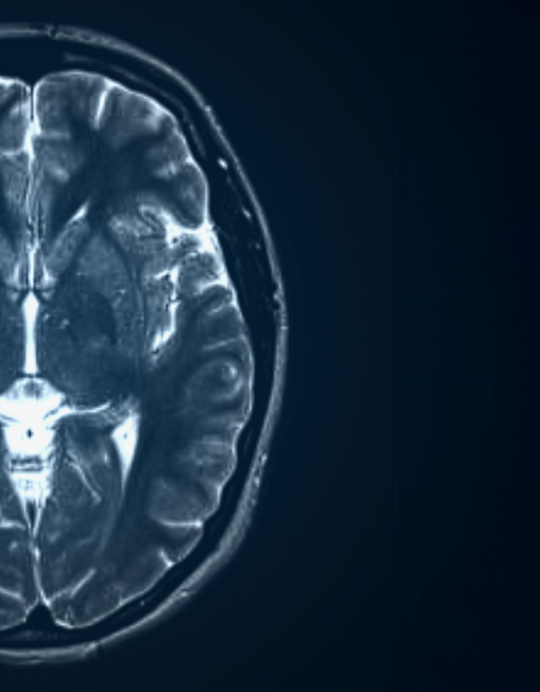 Adicción y adolescencia: consumo temprano y desarrollo cerebral