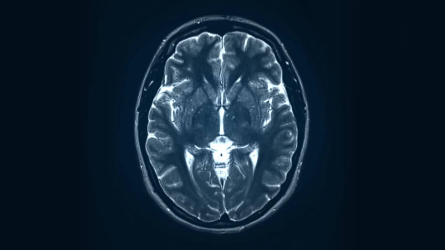 Adicción y adolescencia consumo temprano y desarrollo cerebral